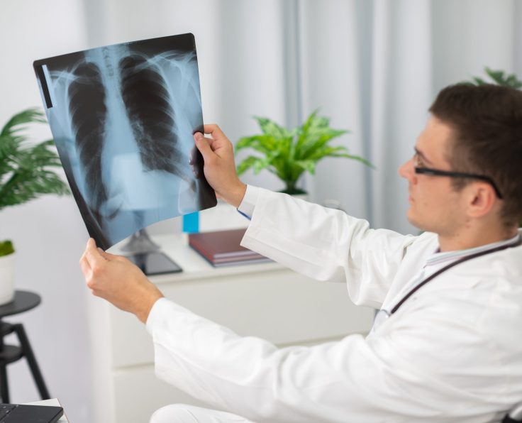 A pulmonologist in his medical office initially checks his patient's lung x-ray.